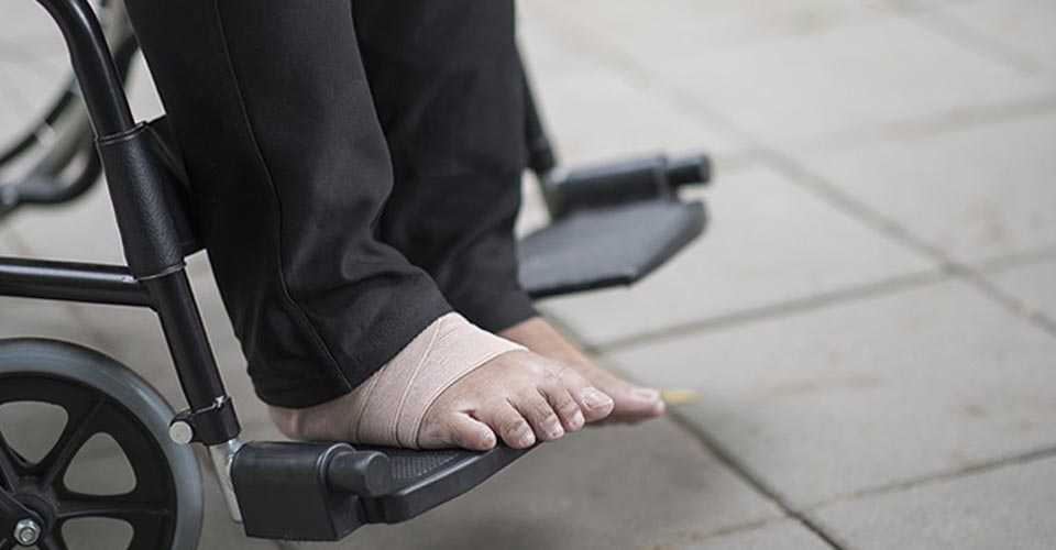 Osteoporosis Treatment in Ayurveda