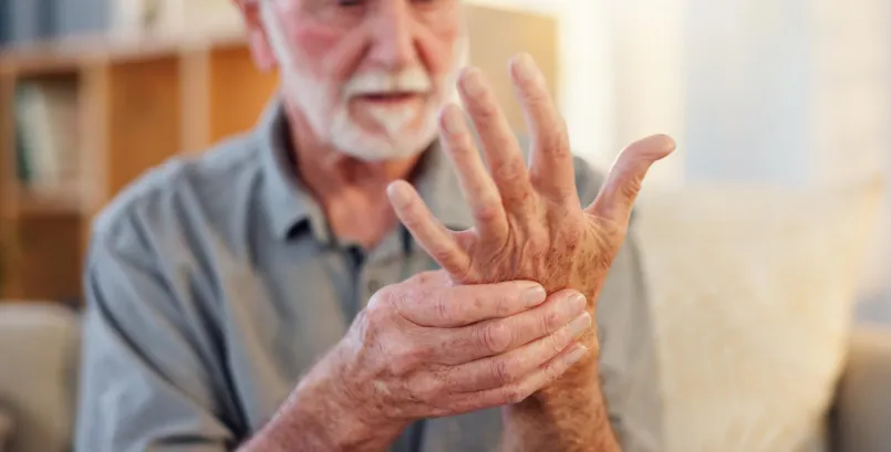 Rheumatoid Arthritis