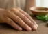 Nail Psoriasis Treatment: Pitting, Ridging & Care